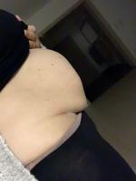 Bauch nach entbindung